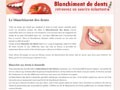 Blanchiment de dents